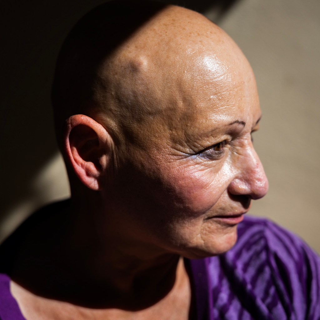 Close-up of an older adult with a shaved head, wearing a purple top, looking to the side in strong directional light.